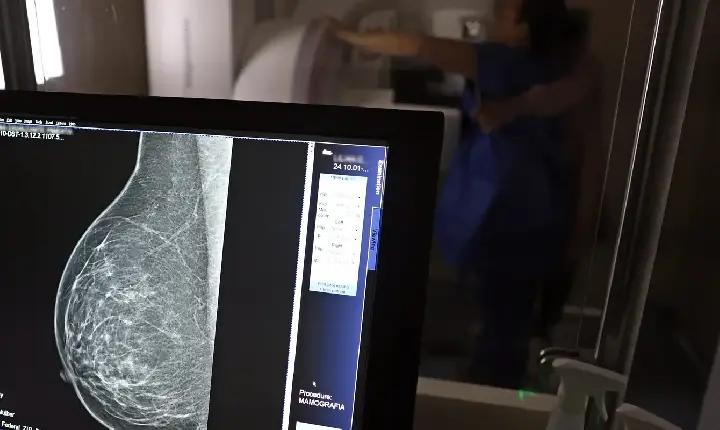 Plano de saúde terá que cobrir mamografia digital para todas as idades